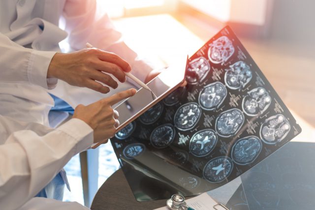 Survival analysis: forecasting lifespans of patients and products